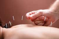 Acupunture : médecine ou charlatanisme ? © Andrey Popov, Fotolia